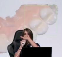 scanning-with-medit-i700