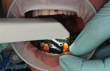 shining-elite-scanner-416x268